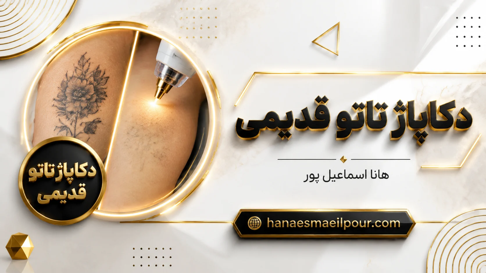 دکاپاژ تاتو قدیمی بهترین روش پاک کردن تاتو در 1405 - هانا اسماعیل پور