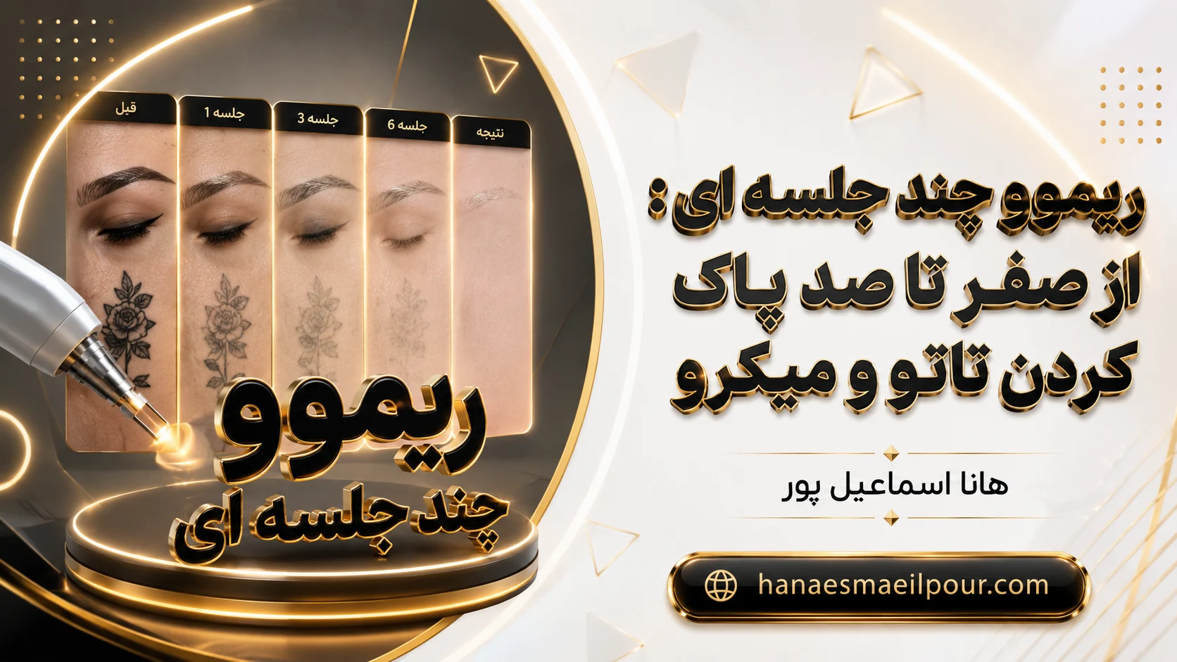 ریموو چند جلسه ای تاتو و میکرو - راهنمای کامل پاک کردن - هانا اسماعیل پور